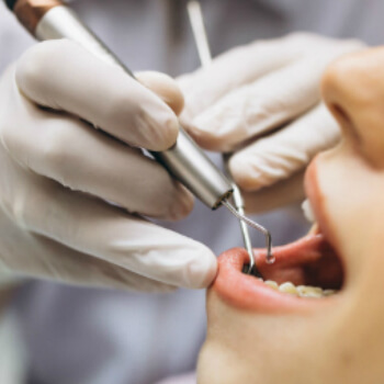Dental Treatment in Vasant Vihar
